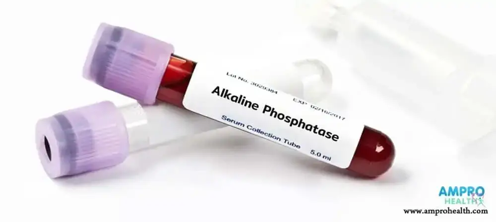การตรวจสาร Alkaline Phosphatase ในตับ การตรวจสาร Alkaline Phosphatase ในตับ