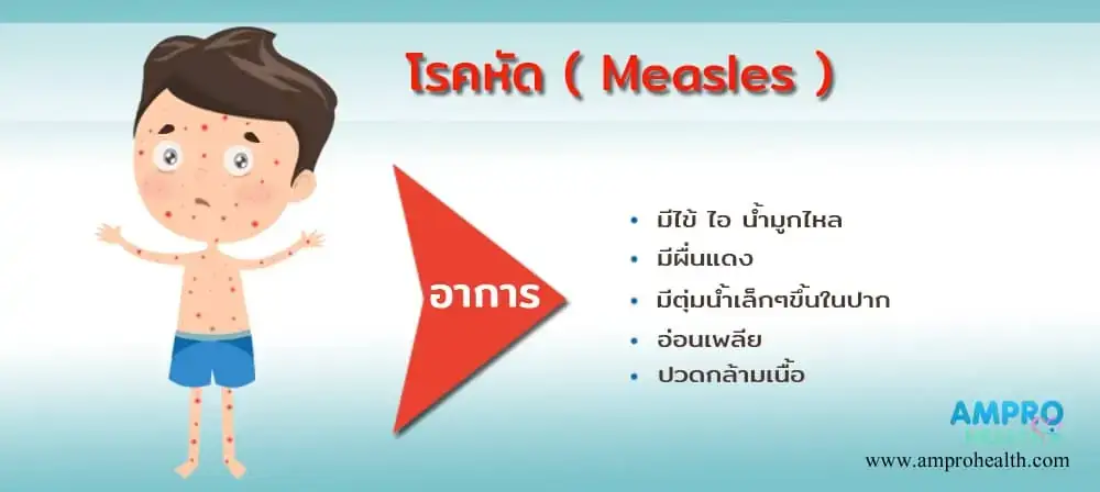 โรคหัด ( Measles ) เกิดได้กับใครบ้าง ? โรคหัด ( Measles ) เกิดได้กับใครบ้าง ?