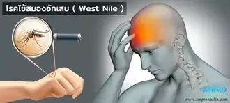 โรคไข้สมองอักเสบ ( West Nile ) โรคไข้สมองอักเสบ ( West Nile )