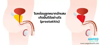 ต่อมลูกหมากอักเสบ ( Prostatitis ) เกิดขึ้นได้อย่างไร ต่อมลูกหมากอักเสบ ( Prostatitis ) เกิดขึ้นได้อย่างไร