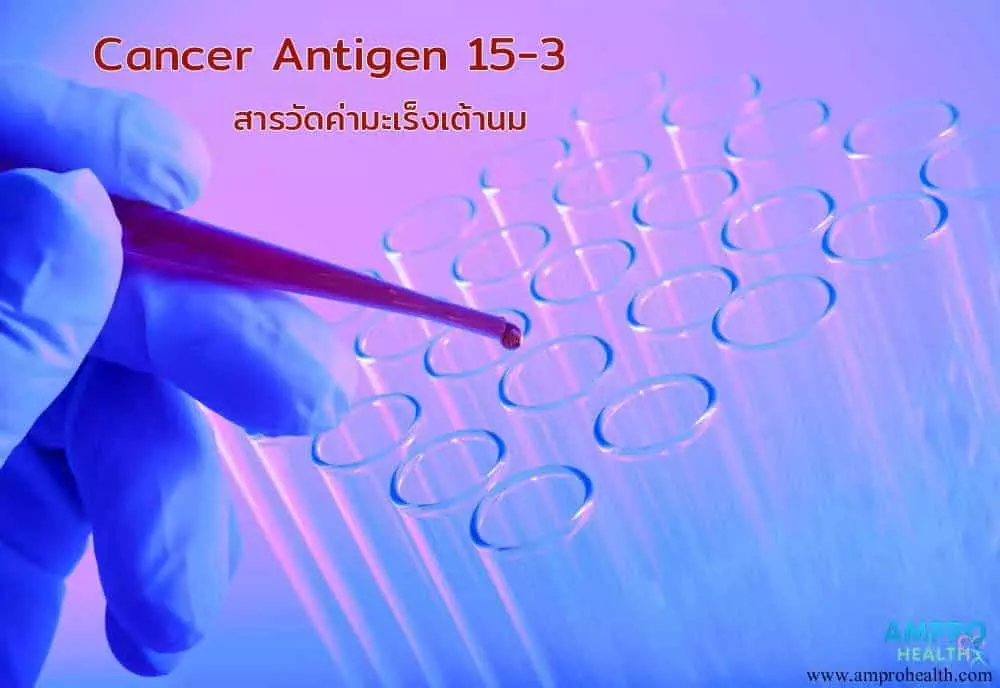 cancer-antigen-15-3-ca-15-3